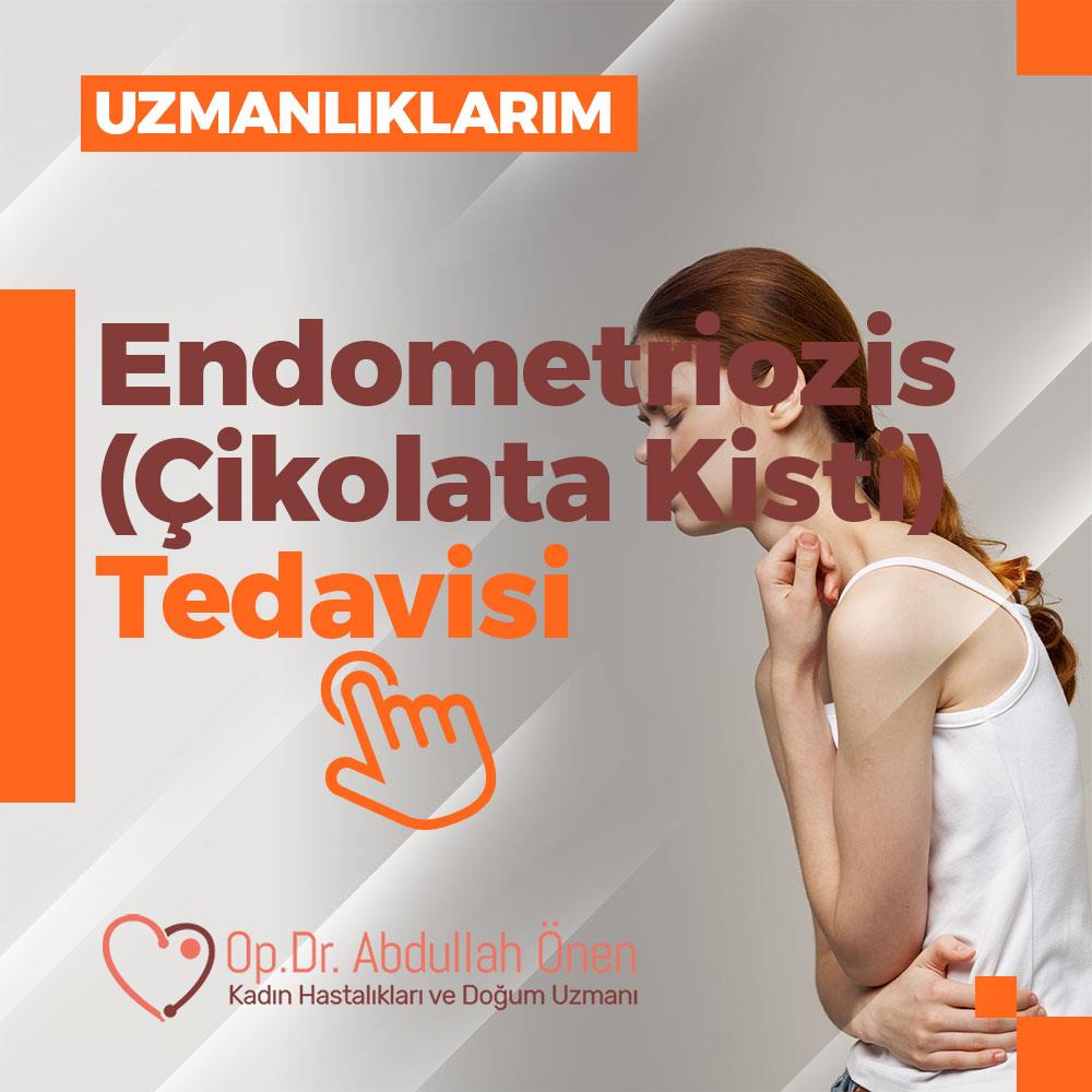 Endometriozis Tedavisi