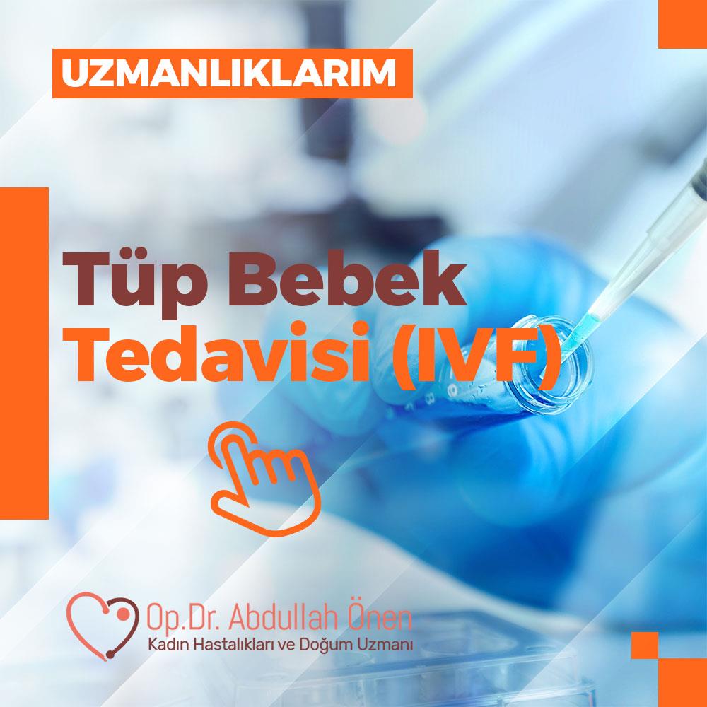 Tüp Bebek Tedavisi